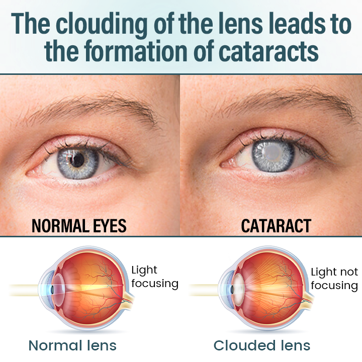 Mayo Clinic recommends👨‍⚕️:  Nano Eye Drops Serum